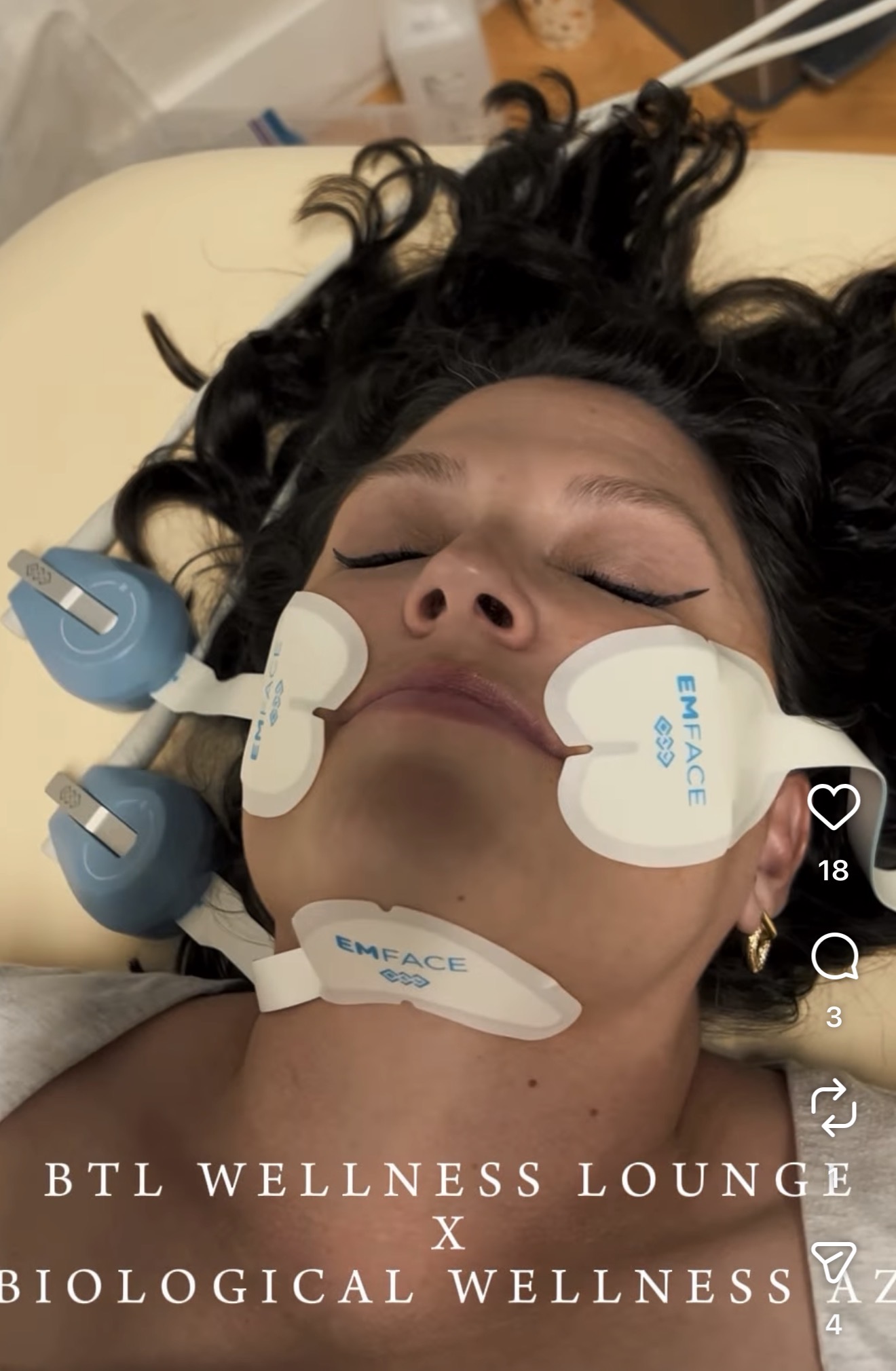 EMFACE treatment at Biological Wellness AZ